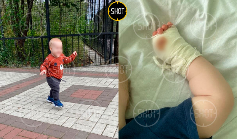 Стало известно о состоянии малыша, которому тигр откусил палец в крымском сафари-парке