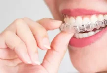 Использование керамических брекетов для исправления прикуса