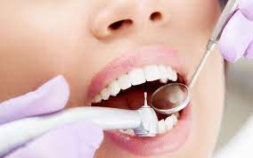 Методы лечения кариеса в стоматологии