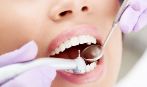 Лечение кариеса зубов: что нужно знать