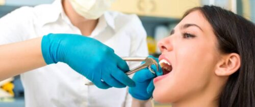 Удаление зубов: особенности процедуры