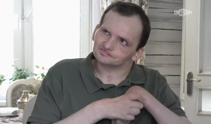 Новые фото пережившего обширный инсульт Алексея Янина: актер 8 лет прикован к инвалидному креслу