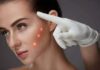 В чем преимущества лазерной косметологии