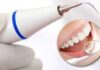 Чистка зубов ультразвуком