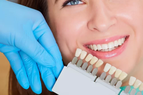 Отбеливание зубов: виды, этапы проведения и рекомендации по уходу