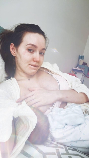 Опухшая от слез Анастасия Костенко поделилась проблемами после госпитализации