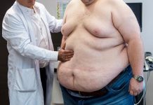 Слишком жирно — терять триллионы рублей из-за не в меру упитанных сограждан