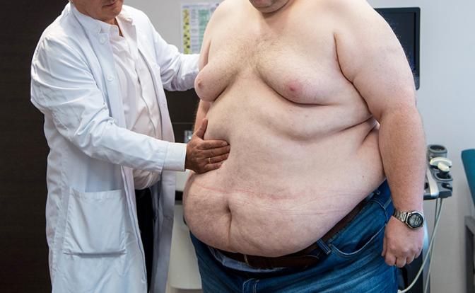 Слишком жирно — терять триллионы рублей из-за не в меру упитанных сограждан