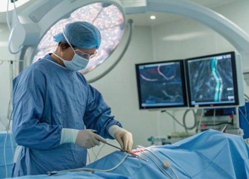 Тромбэктомия: что это за операция и в каких случаях она необходима