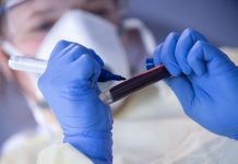 Врач назвала анализ крови, который нужно сдать после новогодних праздников